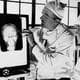 prelobotomy